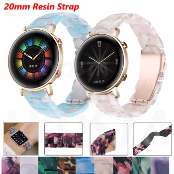 NOVÉ Živice 20 mm Watchband Popruh Pre Huami Amazfit His/GTS 2 Smartwatch Náramok Pre Huawei GT 2 42mm/Magické Hodinky 2 42mm Náramok